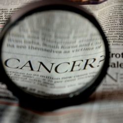 Opciones de Tratamiento del Cáncer de Mama Masculino