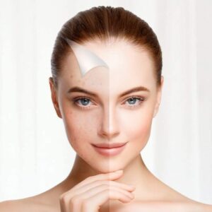 ¿Por Qué las Aspiradoras de Puntos Negros Son Tan Populares?