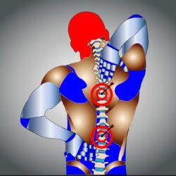 Los mejores correctores de postura para mujer